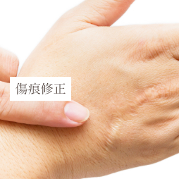 傷痕修正