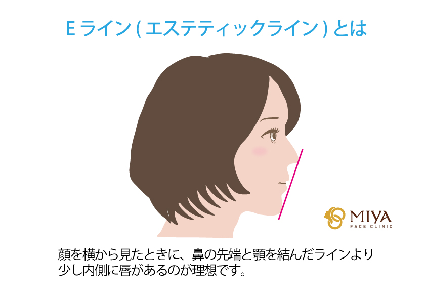 Eライン エステティックライン 大阪 難波で美容整形外科 美容皮膚科ならmiyaフェイスクリニック