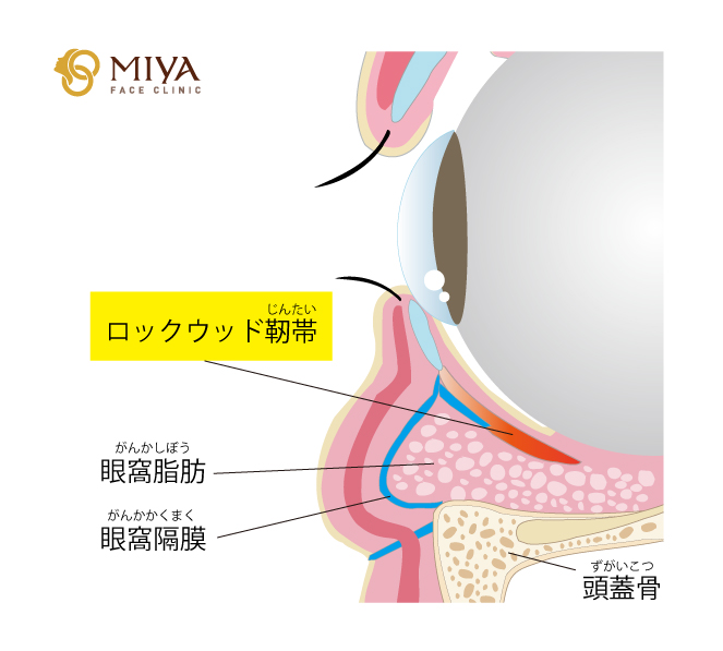 ロックウッド靭帯 | 大阪・難波で美容整形外科・美容皮膚科ならMIYA 