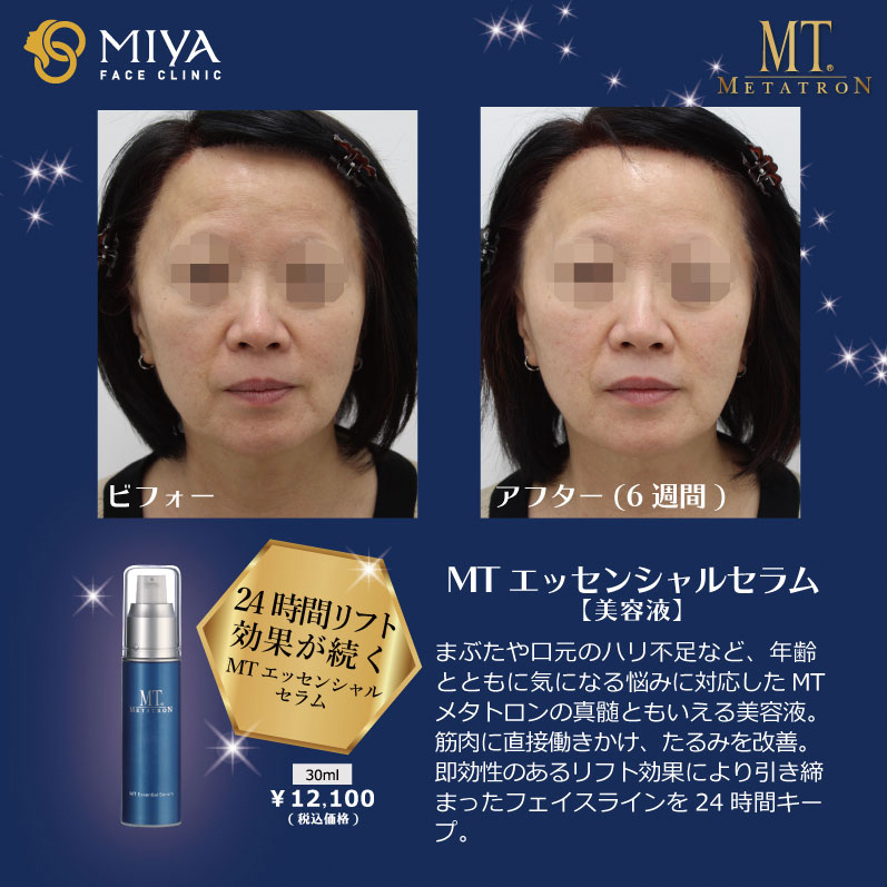 MT メタトロンプレミアムコフレ2021 | 大阪・難波で美容整形外科・美容皮膚科ならMIYAフェイスクリニック