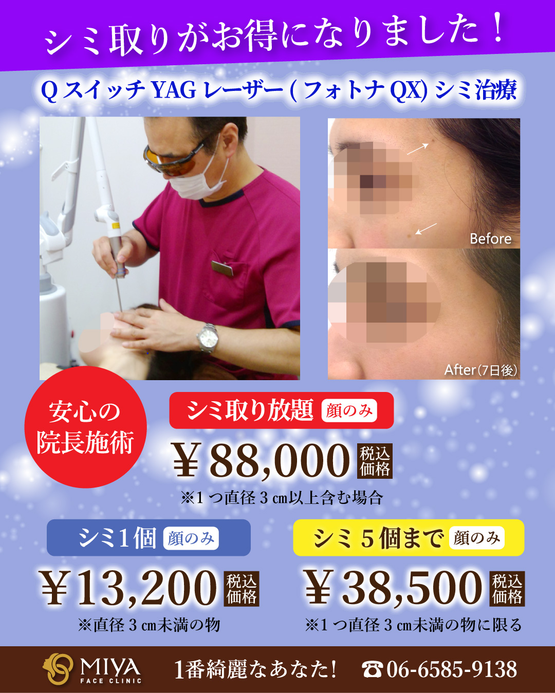 シミ取り治療がお得になりました！ | 大阪・難波で美容整形外科