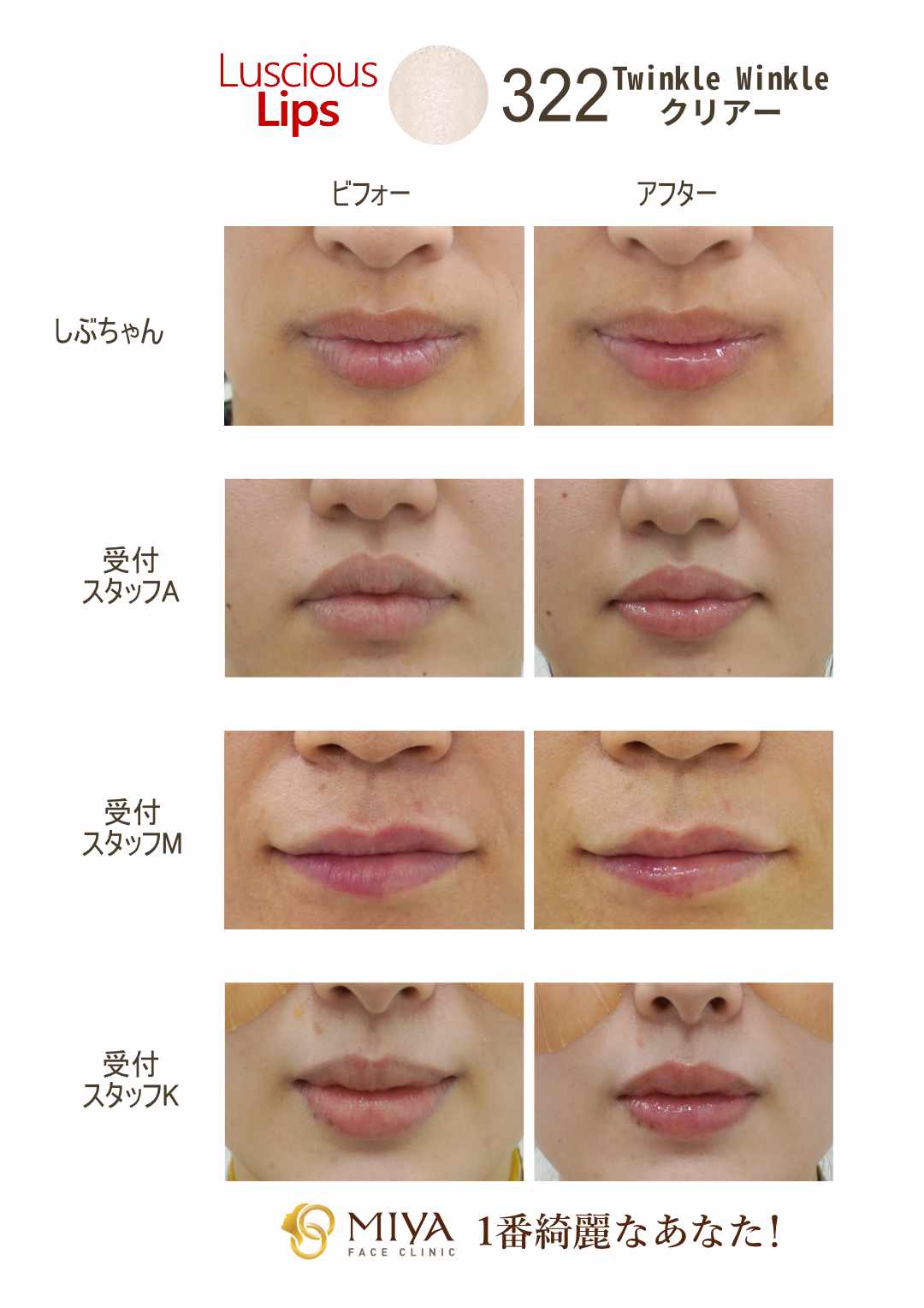 ラシャスリップス322×4｜コスメ/美容 