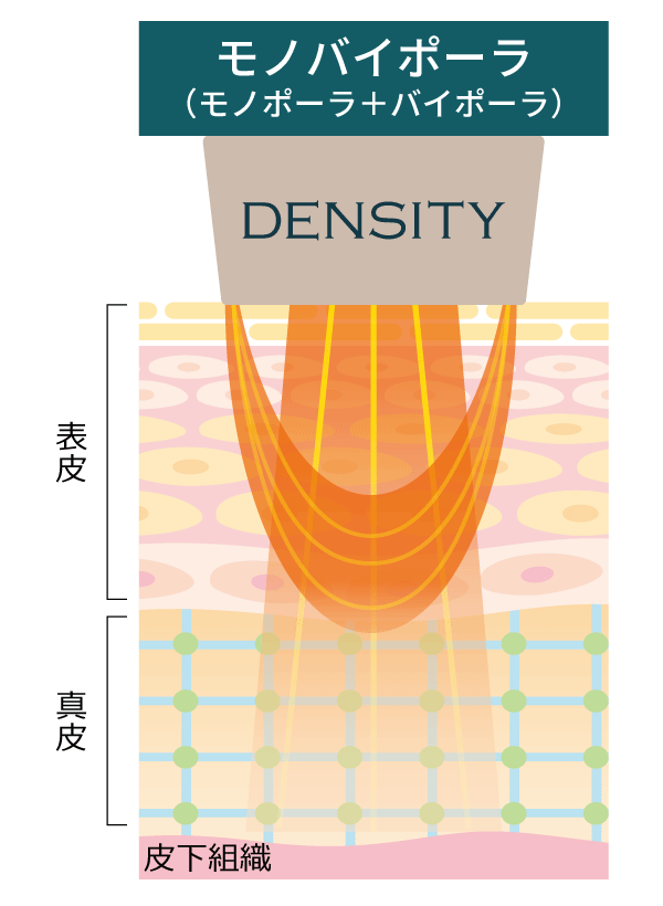 デンシティ モノバイポーラ