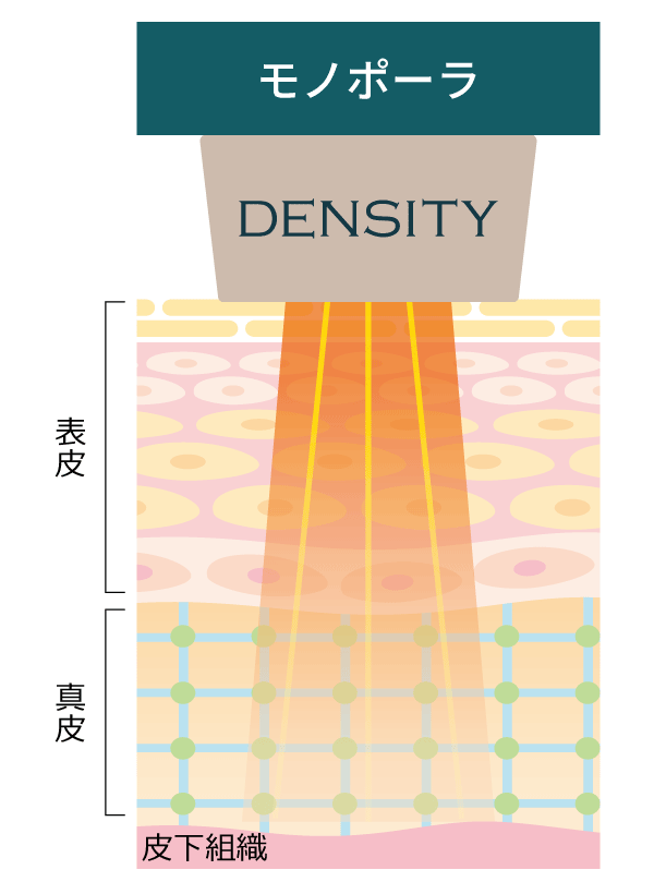 デンシティ モノポーラ