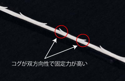 アプトス,糸リフト