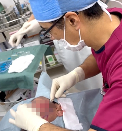 アプトス,糸リフト,施術風景