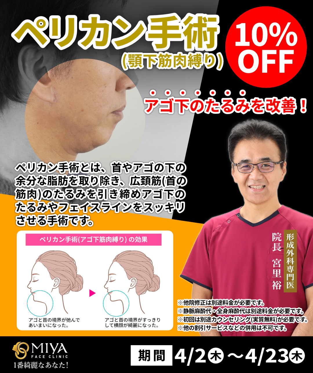 4月限定企画『ペリカン手術』のご案内 | 大阪・難波で美容整形外科