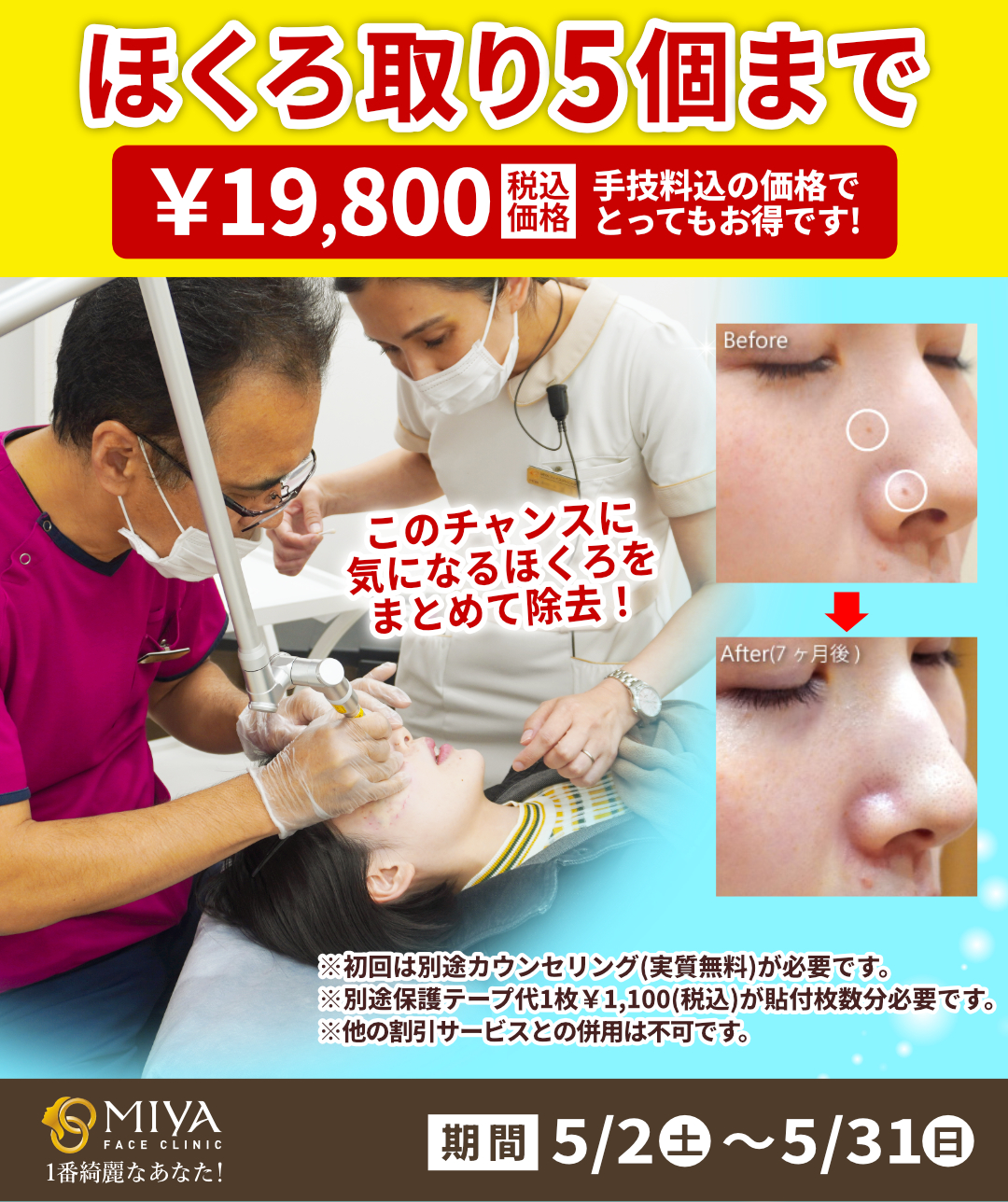 ホクロ手術図鑑 ホクロ手術図鑑【電子版】 | 医書.jp