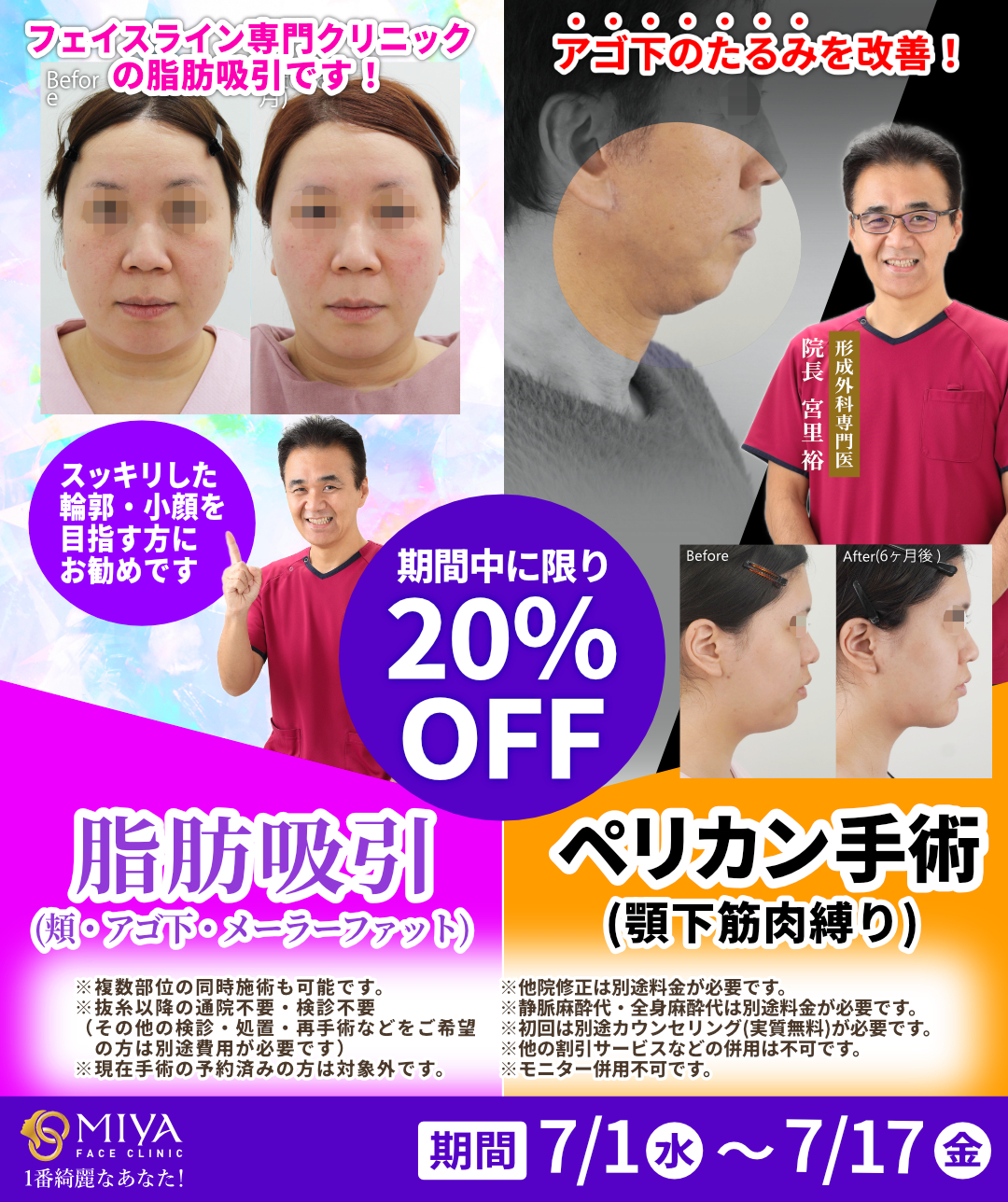 顔の脂肪吸引・ペリカン手術が期間限定20％OFF！ | 大阪・難波で美容