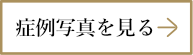 症例写真を見る