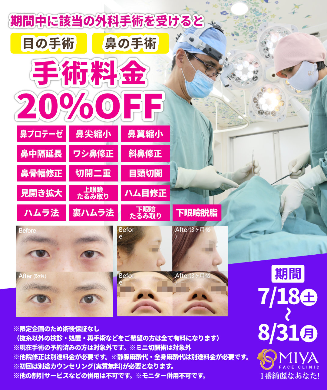 夏休みキャンペーン】目・鼻の美容整形が20％OFF！ | 大阪・難波で美容