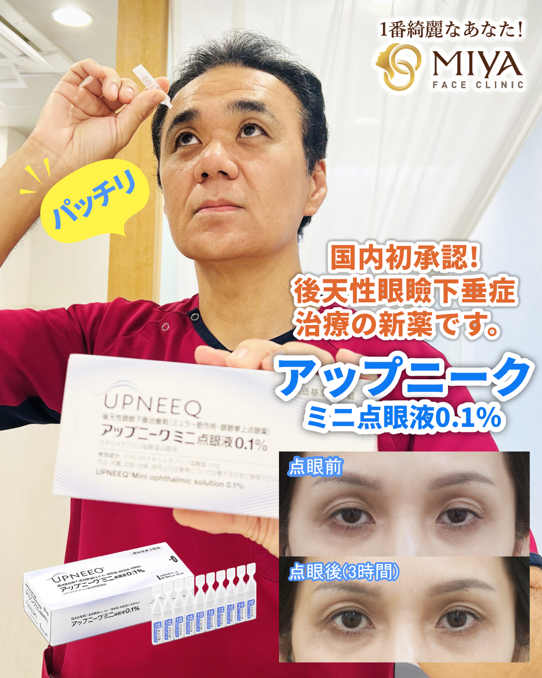 切らない眼瞼下垂治療「アップニーク®」 | 大阪・難波で美容整形外科